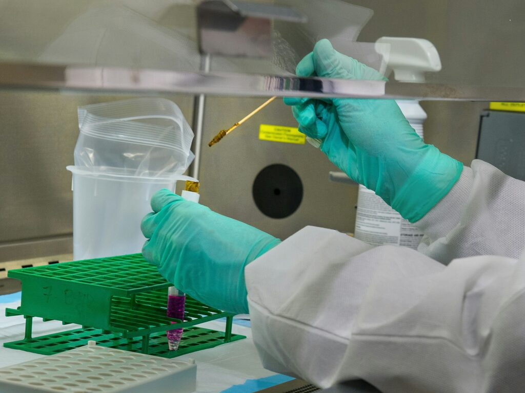 Analisi microbiologiche delle acque: foto di analisi al microscopio